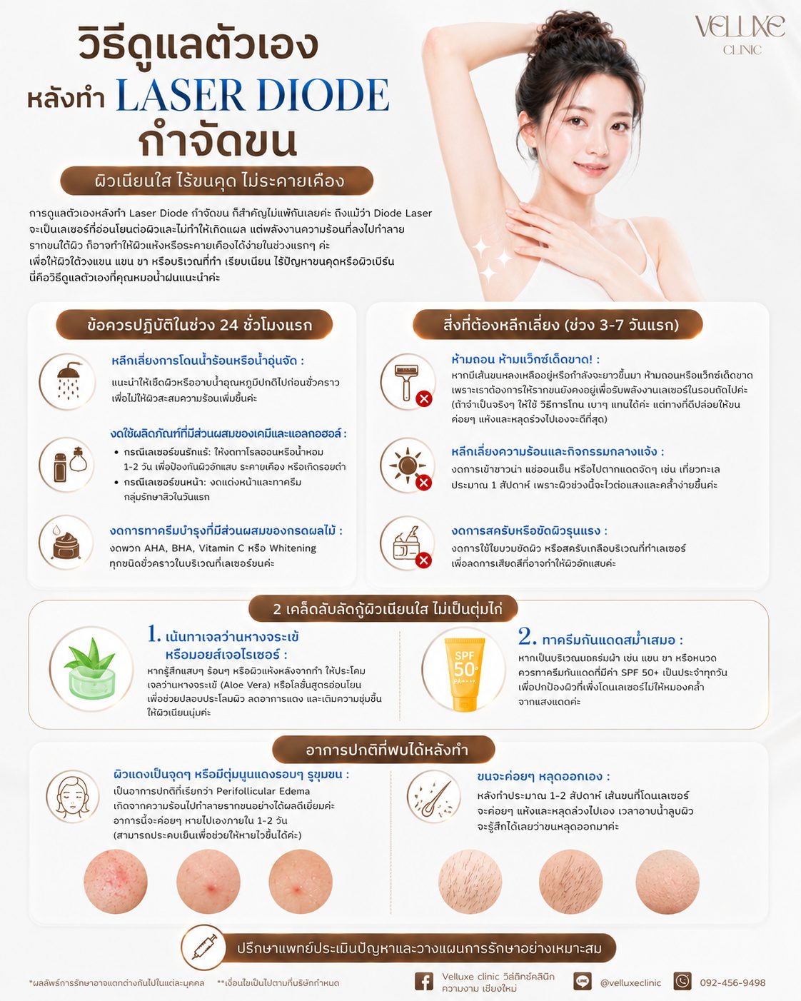 การดูแลตัวเองหลังทำ Diode Laser