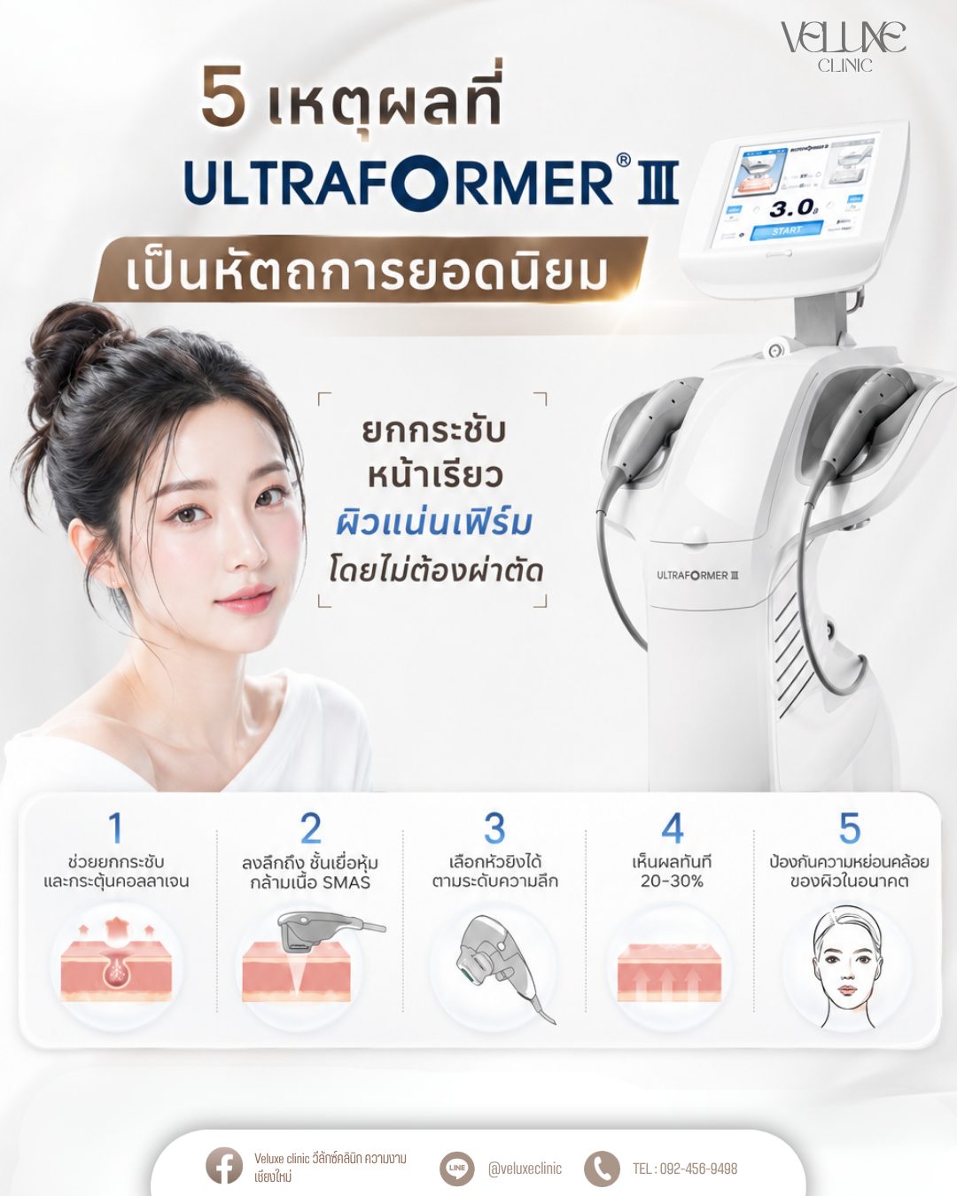 Ultraformer III