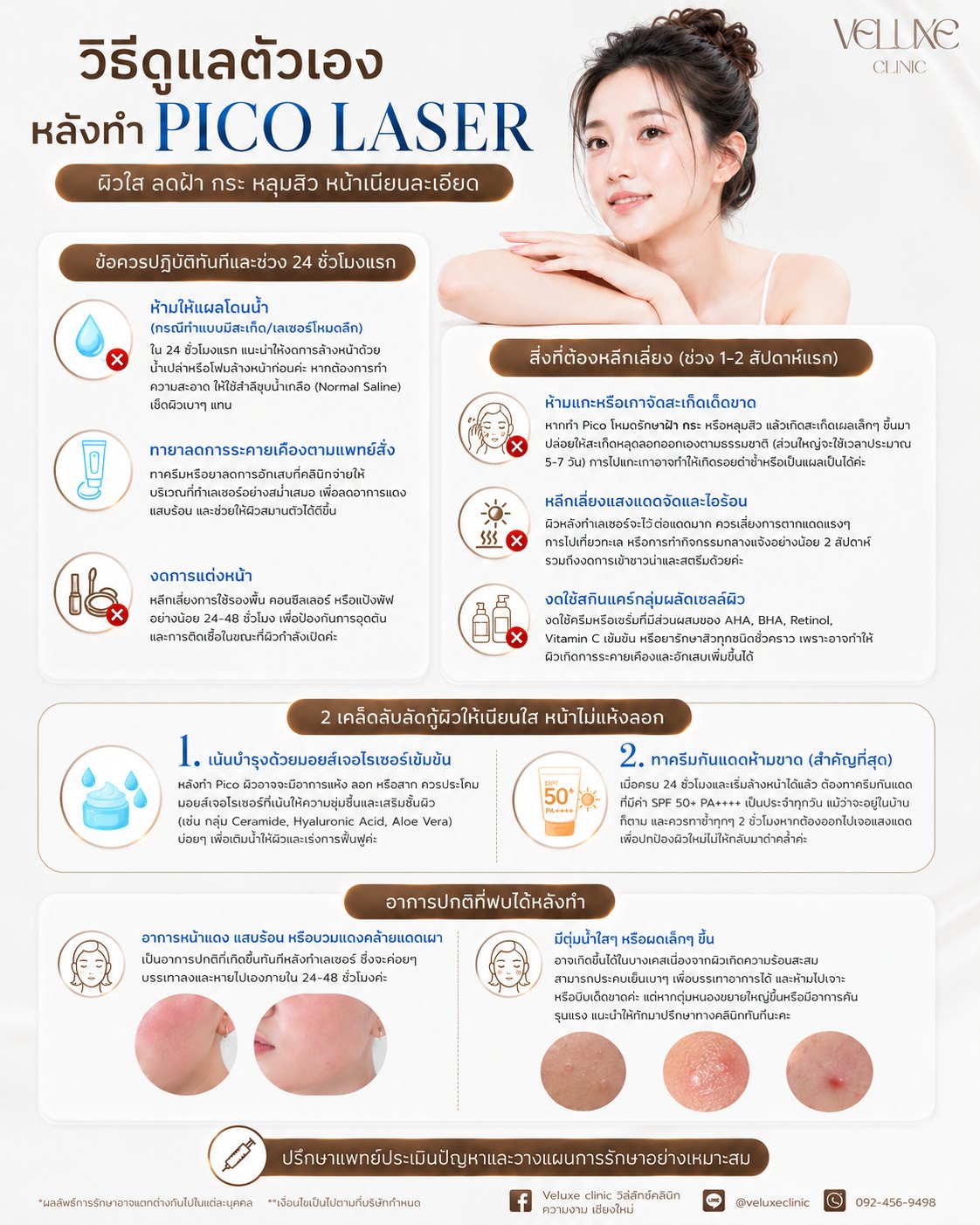 วิธีดูแลตัวเองหลังทำ Pico Laser ข้อควรปฏิบัติในช่วง 24 ชั่วโมงแรก ห้ามใช้ผลิตภัณฑ์กรดแรง AHA BHA เรตินอล วิตามินซี 2 เคล็ดลับสำคัญคือเติมความชุ่มชื้นและทากันแดดทุกวัน และอาการปกติที่พบได้หลังทำ โดย Veluxe Clinic เชียงใหม่