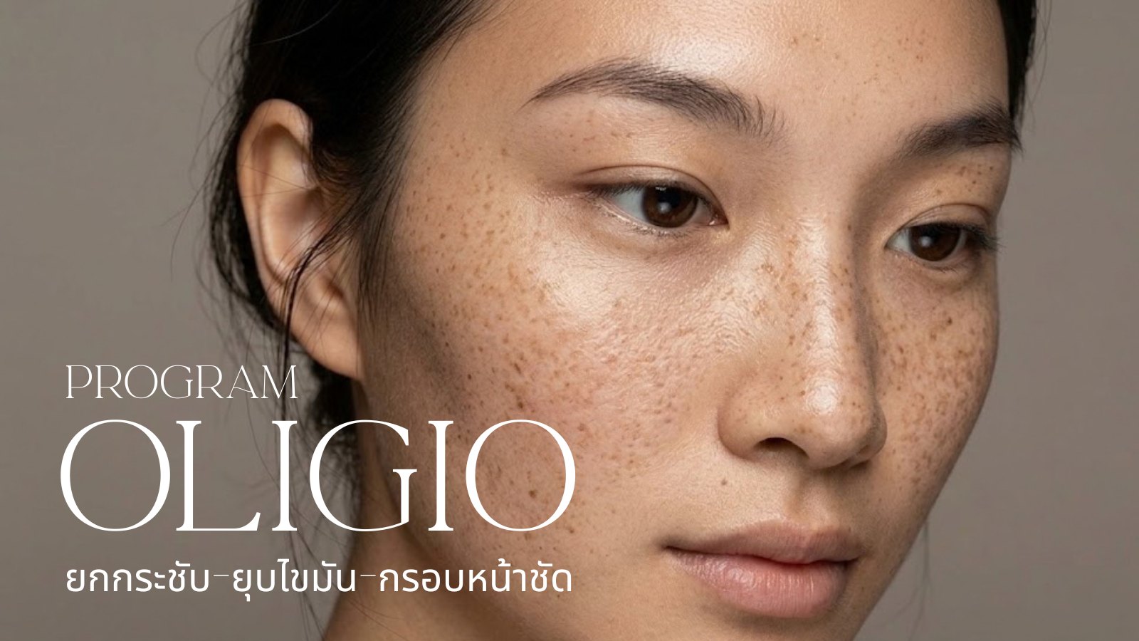 OLIGIO (RF) Veluxe Clinic ချင်းမိုင်