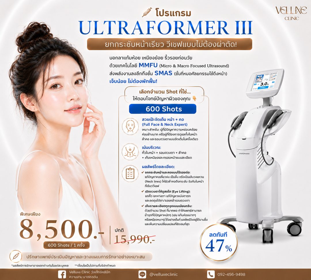 โปรโมชั่น Ultraformer III 600 Shots 8,500 บาท Full Face and Neck Veluxe Clinic เชียงใหม่